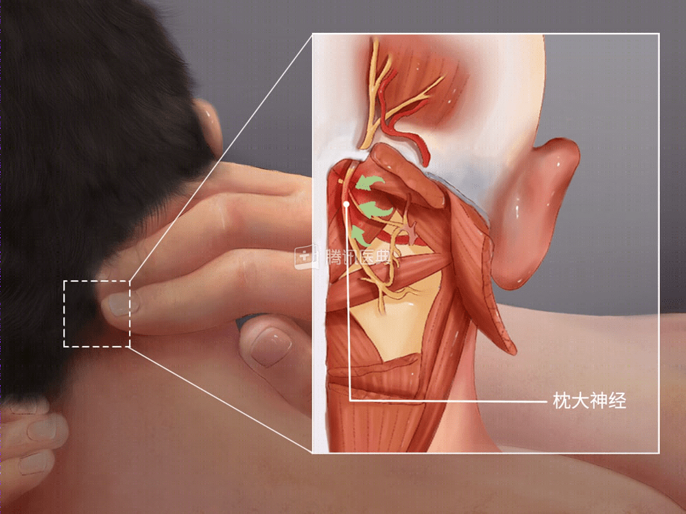 枕头高点好，还是矮点好？答案只有这一个(图4)