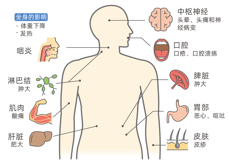 全球已有5名艾滋病患者被治愈，距离终结艾滋病还有多远？(图3)